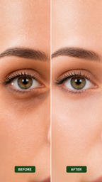 Aloe Vera Anti-Wrinkles Eye Mask